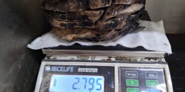 Nefes Darlığına Yol Açan 3 Kiloluk Tümör!